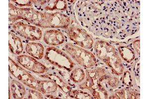 Immunohistochemistry of paraffin-embedded human kidney tissue using ABIN7160596 at dilution of 1:100 (Myosin 9 anticorps  (AA 2-241))