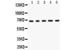 Anti- Menin Picoband antibody, Western blotting All lanes: Anti Menin  at 0. (Menin anticorps  (AA 301-615))