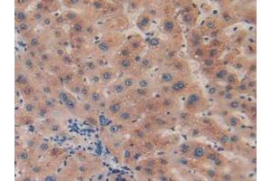 IHC-P analysis of Human Liver Tissue, with DAB staining. (CPB2 anticorps  (AA 138-423))