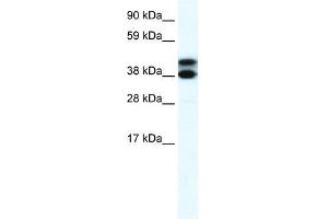 RFP2 antibody used at 2. (TRIM13 anticorps  (Middle Region))