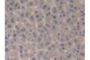 Detection of IL33 in Rat Liver Tissue using Monoclonal Antibody to Interleukin 33 (IL33)