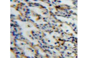 Used in DAB staining on fromalin fixed paraffin-embedded Spleen tissue (SIGLEC5 anticorps  (AA 18-135))