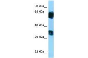 Image no. 1 for anti-Mannosyl (Alpha-1,6-)-Glycoprotein beta-1,6-N-Acetyl-Glucosaminyltransferase, Isozyme B (MGAT5B) (AA 362-411) antibody (ABIN6748202) (MGAT5B anticorps  (AA 362-411))