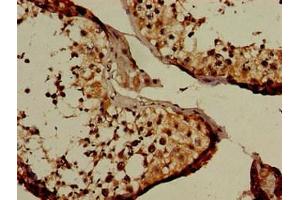 Immunohistochemistry of paraffin-embedded human testis tissue using ABIN7161815 at dilution of 1:100 (NUP107 anticorps  (AA 1-66))