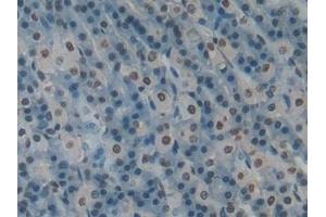 Detection of H3 in Rat Intestine Tissue using Polyclonal Antibody to Histone H3 (H3)
