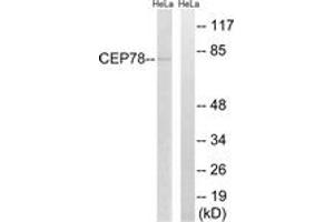 Western blot analysis of extracts from HeLa cells, using CEP78 Antibody. (CEP78 anticorps  (AA 301-350))