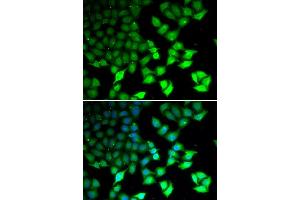 Immunofluorescence analysis of U20S cell using KDM4B antibody. (KDM4B anticorps)