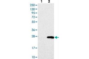 Western blot analysis of Lane 1: Negative control (vector only transfected HEK293T lysate), Lane 2: Over-expression Lysate (Co-expressed with a C-terminal myc-DDK tag (~3. (TMEM204 anticorps)