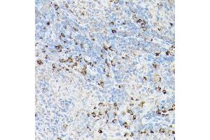 Immunohistochemistry of paraffin-embedded rat spleen using Fas Rabbit pAb (ABIN1683066, ABIN1683065, ABIN5664115 and ABIN6219731) at dilution of 1:100 (40x lens). (FAS anticorps  (AA 61-335))
