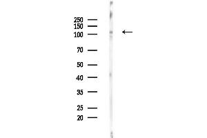 anti-Kinase Suppressor of Ras 1 (KSR1) (Internal Region) antibody