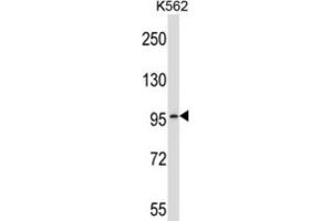 Western Blotting (WB) image for anti-phosphodiesterase 6A, CGMP-Specific, Rod, alpha (PDE6A) antibody (ABIN2997217) (PDE6A anticorps)
