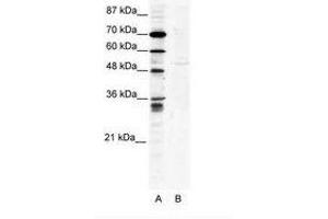 Image no. 1 for anti-Zinc Finger Protein 134 (ZNF134) (AA 93-142) antibody (ABIN202498) (ZNF134 anticorps  (AA 93-142))