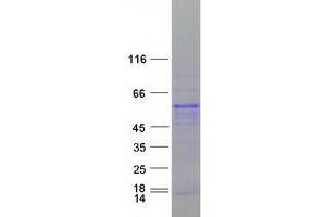 Validation with Western Blot