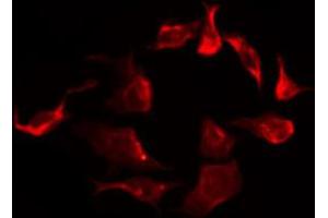 ABIN6267266 staining SK-OV3 by IF/ICC. (EGFR anticorps  (pTyr869))