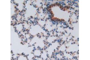 IHC-P analysis of Mouse Lung Tissue, with DAB staining. (HEXB anticorps  (AA 101-217))