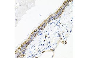 Immunohistochemistry of paraffin-embedded human lung using A antibody (ABIN3015791, ABIN3015792, ABIN3015793 and ABIN6219141) at dilution of 1:100 (40x lens).