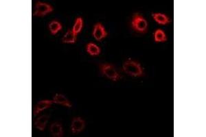 Immunofluorescent analysis of CDK6 staining in K562 cells. (CDK6 anticorps)