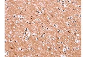The image on the left is immunohistochemistry of paraffin-embedded Human brain tissue using ABIN7190562(ENPP4 Antibody) at dilution 1/15, on the right is treated with synthetic peptide.