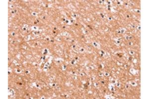 The image on the left is immunohistochemistry of paraffin-embedded Human brain tissue using ABIN7190562(ENPP4 Antibody) at dilution 1/15, on the right is treated with synthetic peptide. (ENPP4 anticorps)