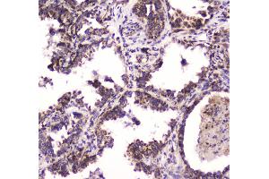 IHC analysis of BRD7 using anti-BRD7 antibody .