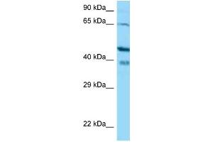 Western Blotting (WB) image for anti-Calcium Binding Protein 1 (CABP1) (N-Term) antibody (ABIN2774384) (CABP1 anticorps  (N-Term))