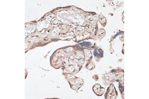 Immunohistochemistry of paraffin-embedded human placenta using SPDEF antibody (ABIN6132572, ABIN6148332, ABIN6148334 and ABIN6218364) at dilution of 1:100 (40x lens).