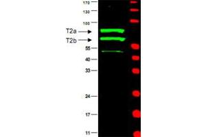 Western blot using CCNT2 polyclonal antibody  is shown to detect two major bands (arrowheads) corresponding to human CCN T2a and T2b as indicated. (Cyclin T2 anticorps)