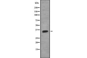 Western blot analysis OR51G1 using HuvEc whole cell lysates (OR51G1 anticorps)