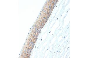 Immunohistochemistry of paraffin-embedded rat cornea using CR Rabbit mAb (ABIN7266269) at dilution of 1:100 (40x lens).