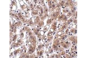 Immunohistochemistry of THEM4 in human liver tissue with this product at 2. (THEM4 anticorps  (Center))