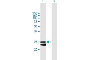 Western Blot analysis of FKBP14 expression in transfected 293T cell line by FKBP14 MaxPab polyclonal antibody. (FKBP14 anticorps  (AA 1-211))