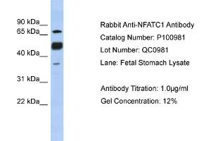 WB Suggested Anti-NFATC1  Antibody Titration: 0. (NFATC1 anticorps  (N-Term))