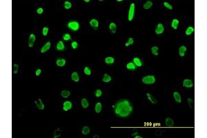 Immunofluorescence of monoclonal antibody to MCM3 on HeLa cell.