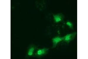 Anti-SPR mouse monoclonal antibody (ABIN2453682) immunofluorescent staining of COS7 cells transiently transfected by pCMV6-ENTRY SPR (RC205679). (SPR anticorps)
