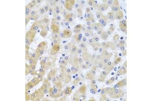 Immunohistochemistry of paraffin-embedded human liver injury using EIF3M antibody at dilution of 1:100 (x40 lens). (Eukaryotic Translation Initiation Factor 3, Subunit M (EIF3M) anticorps)