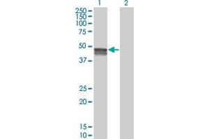 Western Blot analysis of SMPDL3B expression in transfected 293T cell line by SMPDL3B monoclonal antibody (M01), clone 5E12. (SMPDL3B anticorps  (AA 274-372))