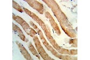 IHC analysis of FFPE human skeletal muscle stained with RAB7 antibody (RAB7A anticorps  (AA 176-204))