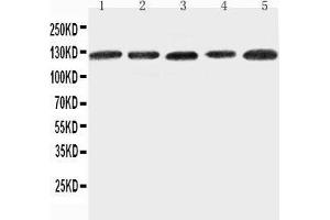 Anti-ITGA7 antibody, Western blotting Lane 1: 293T Cell Lysate Lane 2: A431 Cell Lysate Lane 3: HELA Cell Lysate Lane 4: JURKAT Cell Lysate Lane 5: RAJI Cell Lysate (ITGA7 anticorps  (C-Term))