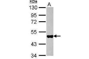 WB Image Sample (30 ug of whole cell lysate) A: HeLa 10% SDS PAGE antibody diluted at 1:10000 (KRT17 anticorps)