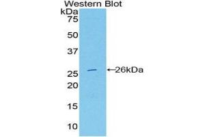 Western Blotting (WB) image for anti-Deoxyribonuclease I-Like 2 (DNASE1L2) (AA 32-229) antibody (ABIN3209086) (DNASE1L2 anticorps  (AA 32-229))