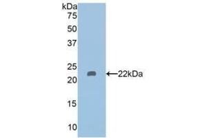 Detection of Recombinant HDAC6, Human using Polyclonal Antibody to Histone Deacetylase 6 (HDAC6)