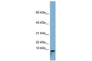 TCTA antibody used at 1 ug/ml to detect target protein. (TCTA anticorps  (Middle Region))