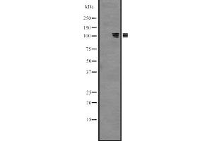 Western blot analysis of PKN3 expression in Hela cell lysate,The lane on the left is treated with the antigen-specific peptide. (PKN3 anticorps  (Internal Region))