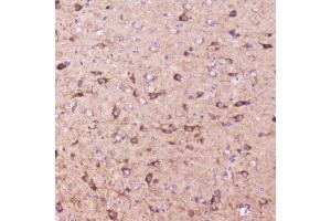 IHC analysis of IGFBP2 using anti-IGFBP2 antibody (ABIN5693239).