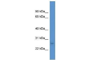 Western Blot showing CALB1 antibody used at a concentration of 1.