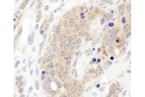 Immunohistochemistry (IHC) image for anti-Chaperonin Containing TCP1, Subunit 3 (Gamma) (CCT3) (AA 495-545) antibody (ABIN7453615)