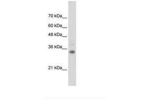 Image no. 1 for anti-Homeobox B4 (HOXB4) (C-Term) antibody (ABIN6736307) (HOXB4 anticorps  (C-Term))
