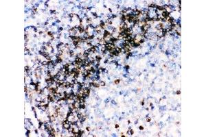 IHC-P: CD79a antibody testing of human tonsil tissue (CD79a anticorps  (AA 121-226))