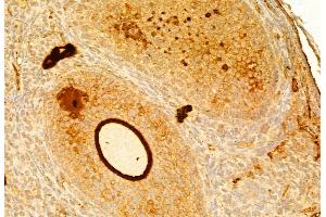 ABIN6261746 and ABIN6268882 at 1/100 staining Mouse ovary tissue by IHC-P. (Fibronectin anticorps  (C-Term))