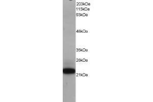 Western Blotting (WB) image for anti-MYC Associated Factor X (MAX) antibody (ABIN5871017) (MAX anticorps)